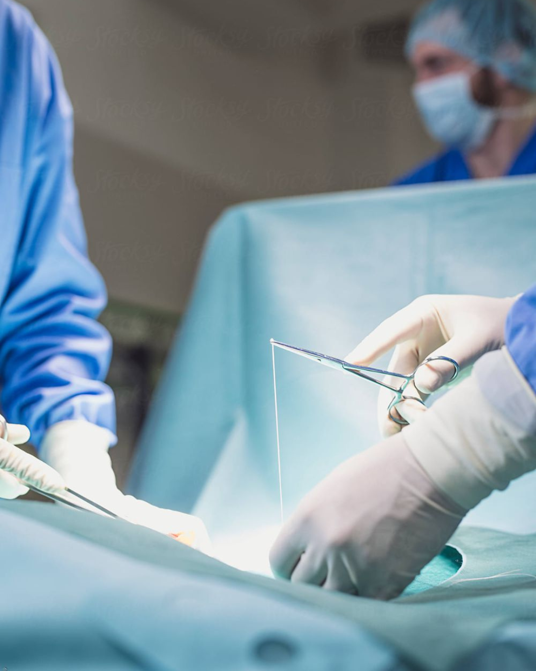 Image of ABDOMINOPLASTIA
