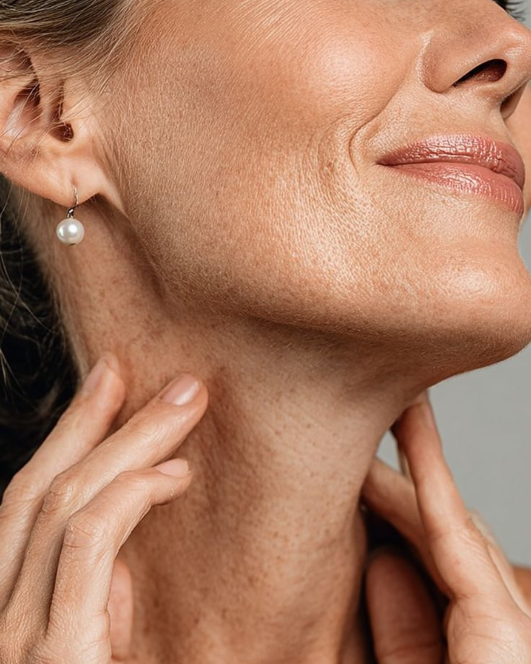 BIOESTIMULADOR DE COLÁGENO / SCULPTRA