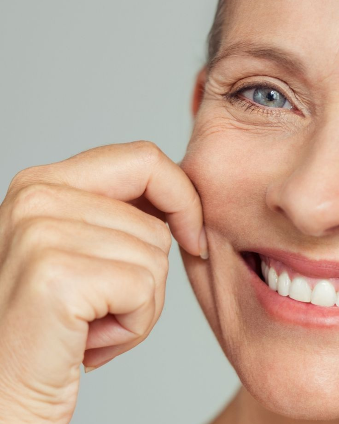 BIOESTIMULADOR DE COLÁGENO / RADIESSE