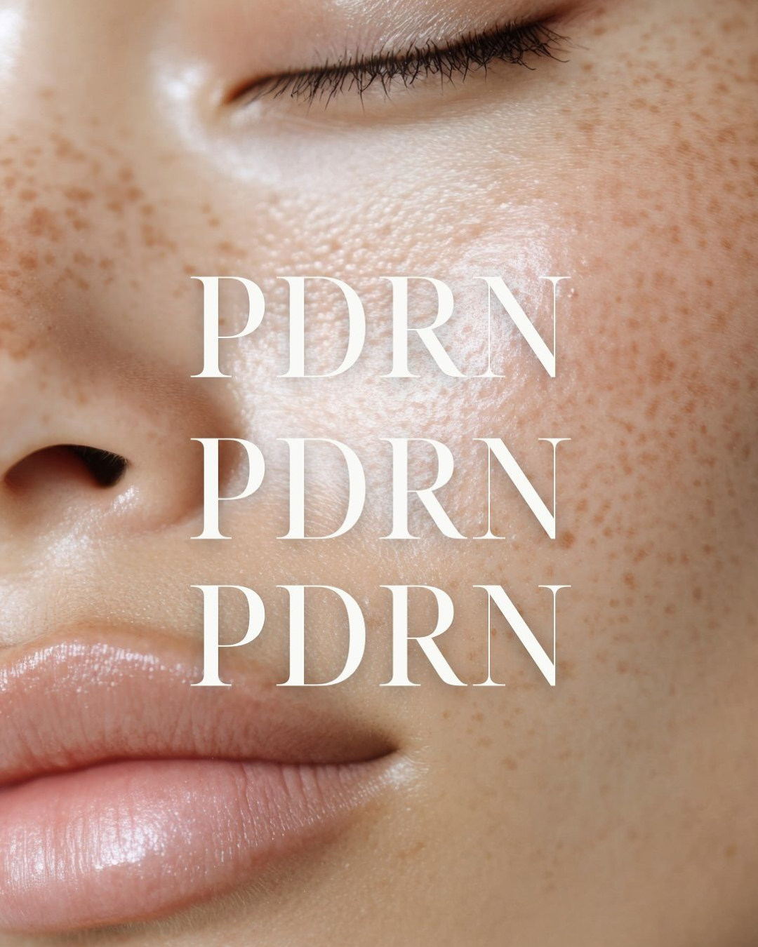 REGENERACIÓN CON ADN DE SALMÓN / POLINUCLEÓTIDOS