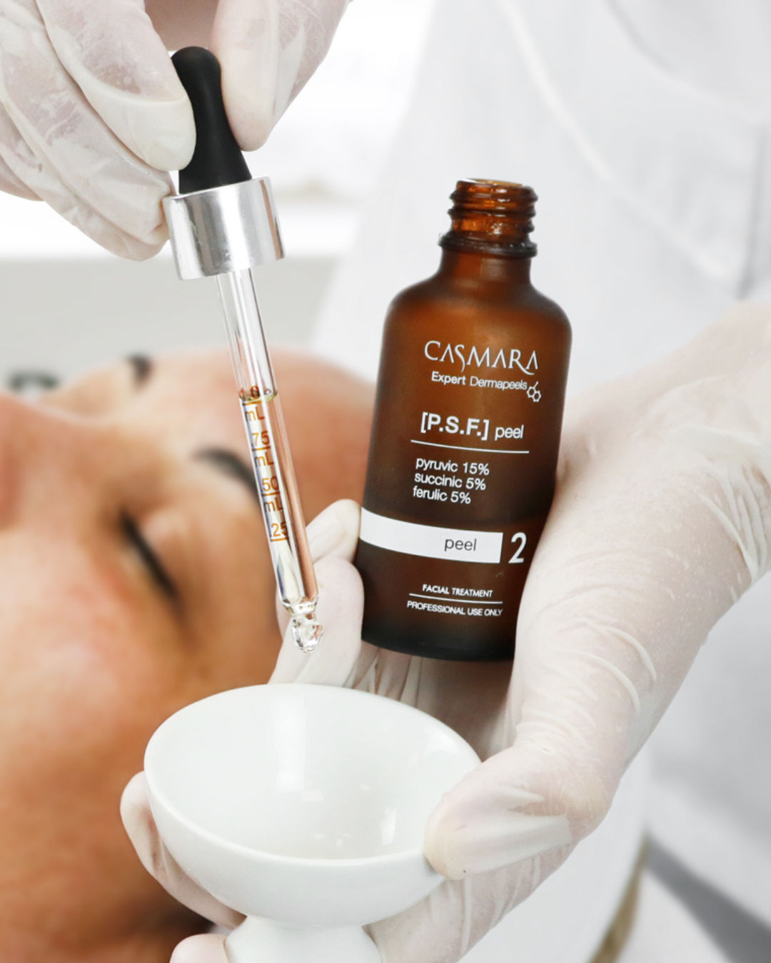 Image of PEELING QUÍMICO CASMARA | RENUEVA Y RESTAURA TU PIEL