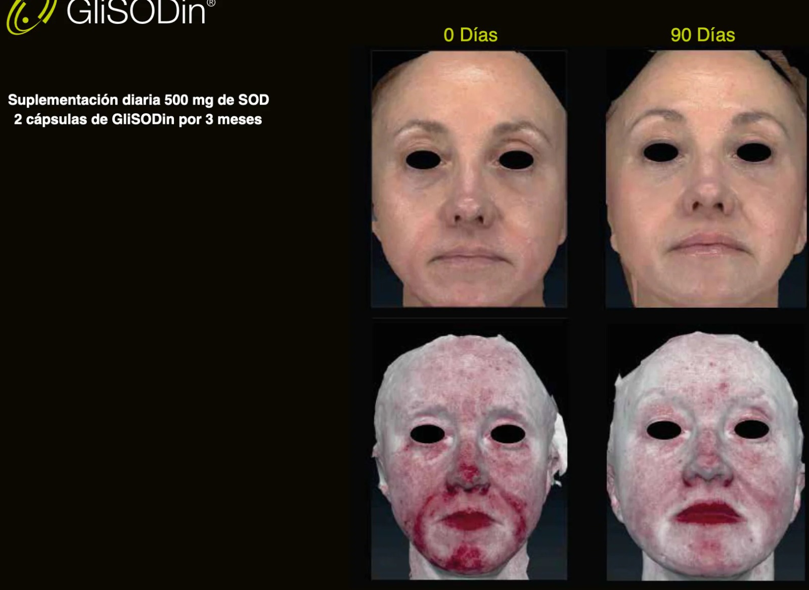 foto para producto detras de glisodin